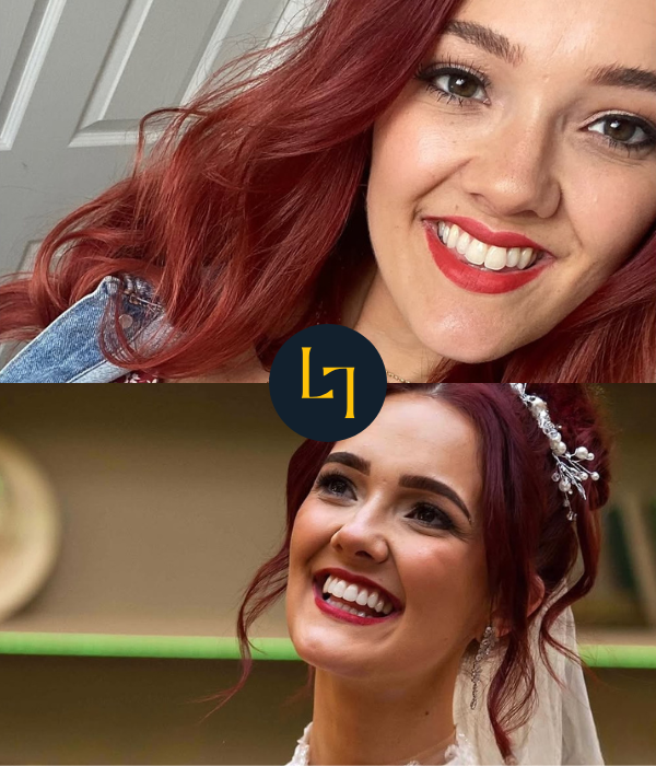invisalign before and after wedding photo