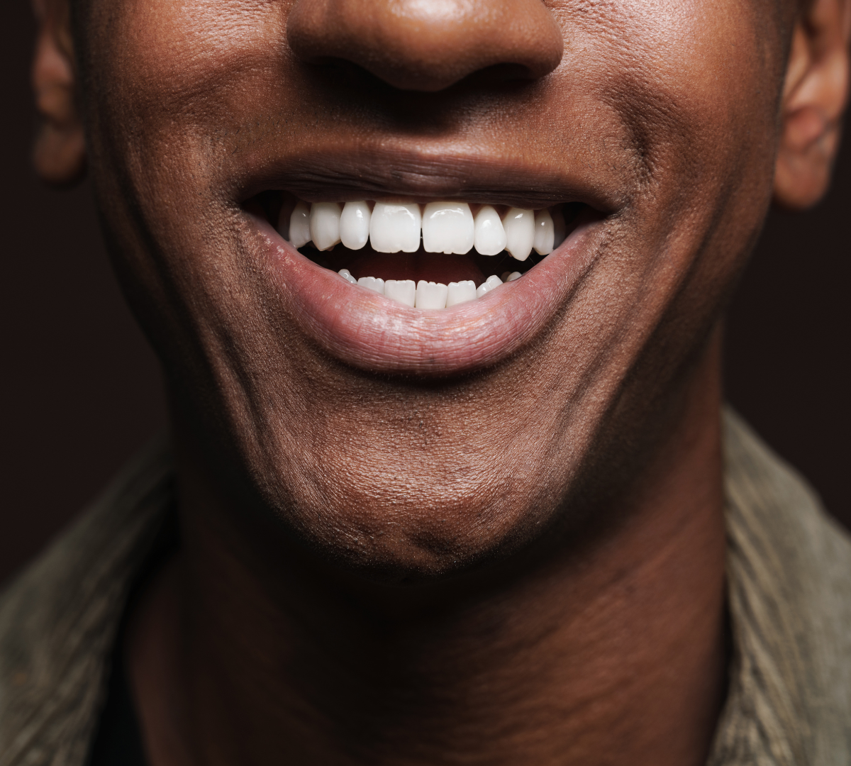 Zoomed in smile of a man showing off his bright teeth after teeth whitening treatment in Sheffield