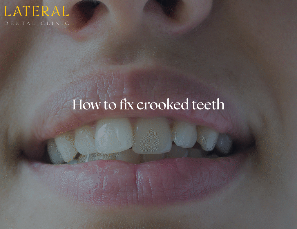 crooked teeth - how to fix crooked teeth