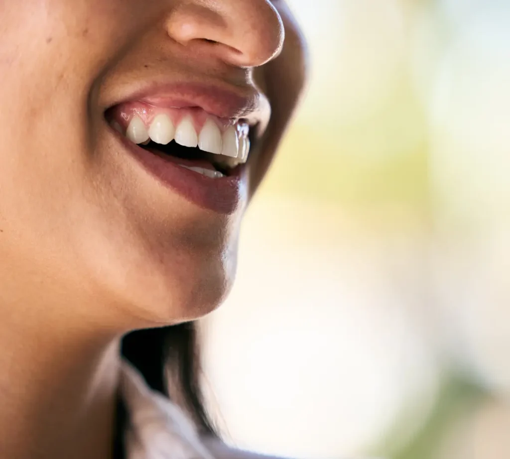 composite bonding sheffield close-up photo with a girl smile
