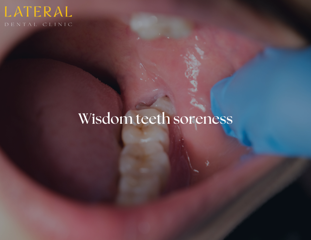 wisdom teeth soreness - half-erupted wisdom tooth