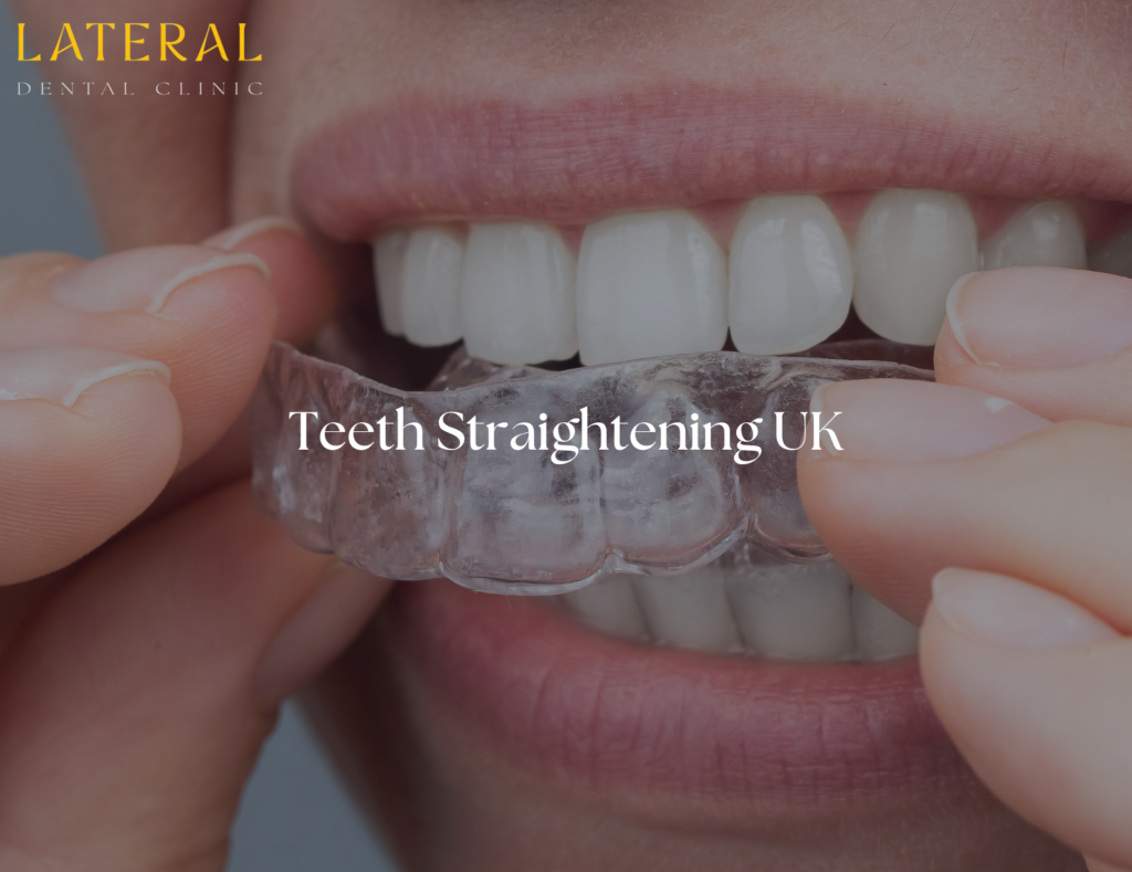 teeth straightening uk - how clear aligners look on teeth