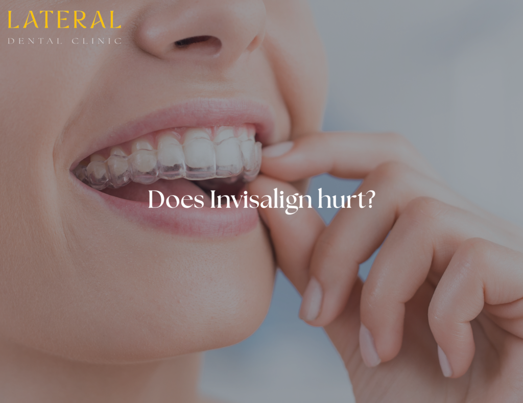 does invisalign hurt - blog about Invisalign